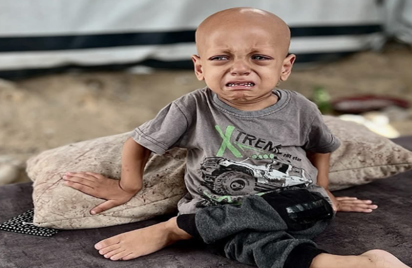 وفاة الطفل الغزاوي صاحب صرخة أنا جعان في تركيا ( فيديو)