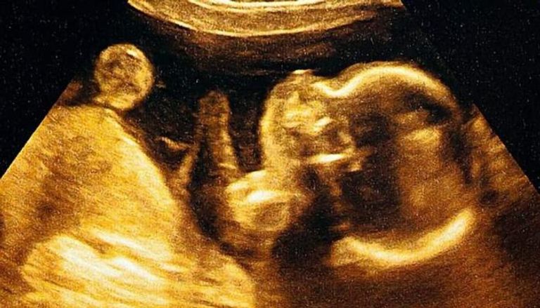 وداعا للتقديرات التقليدية.. الذكاء الاصطناعي يكشف موعد ميلاد طفلك بدقة عالية