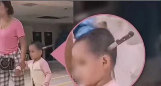 صور لسكين مغروس في جمجمة طفلة تثير الفزع.. والأم تصطحبها ب هدوء للمستشفى