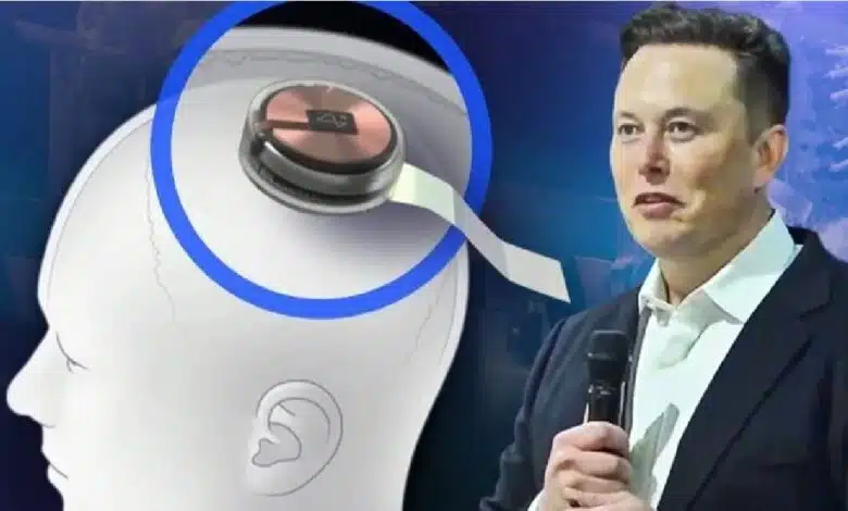 نيورالينك المملوكة لماسك تزرع شرائح دماغية ل12 شخصاً