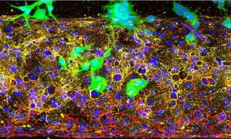 الكشف عن السلاح الخفي الذي يغذي انتشار سرطان البنكرياس