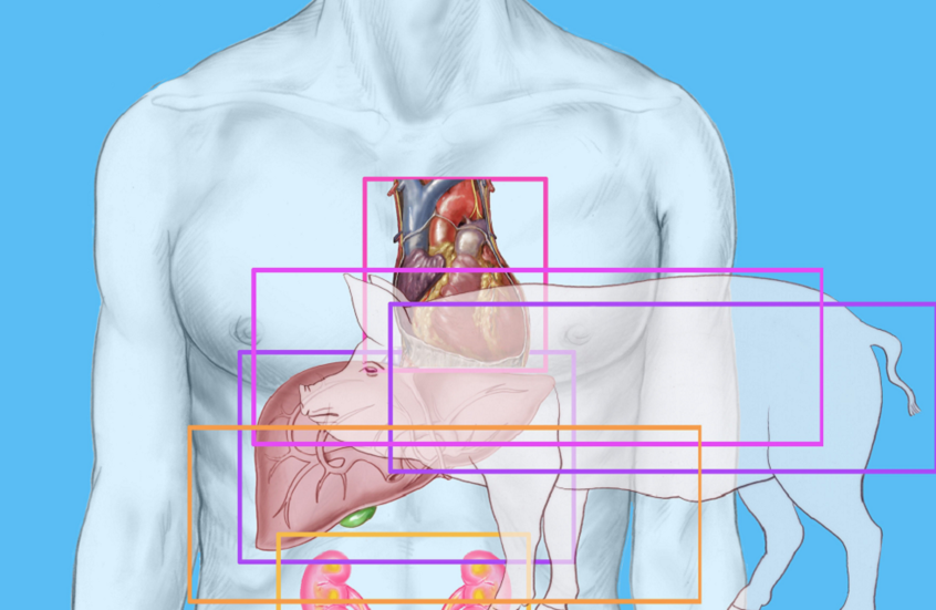 بعد نجاحها على مريض ميت سريريا.. الصين تحقق إنجازا تاريخيا بزراعة كبد خنزير معدل وراثيا لمريض حي