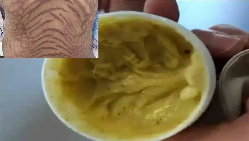 سيدة يتحول جلدها لجلد الثعبان..و السبب كريم !