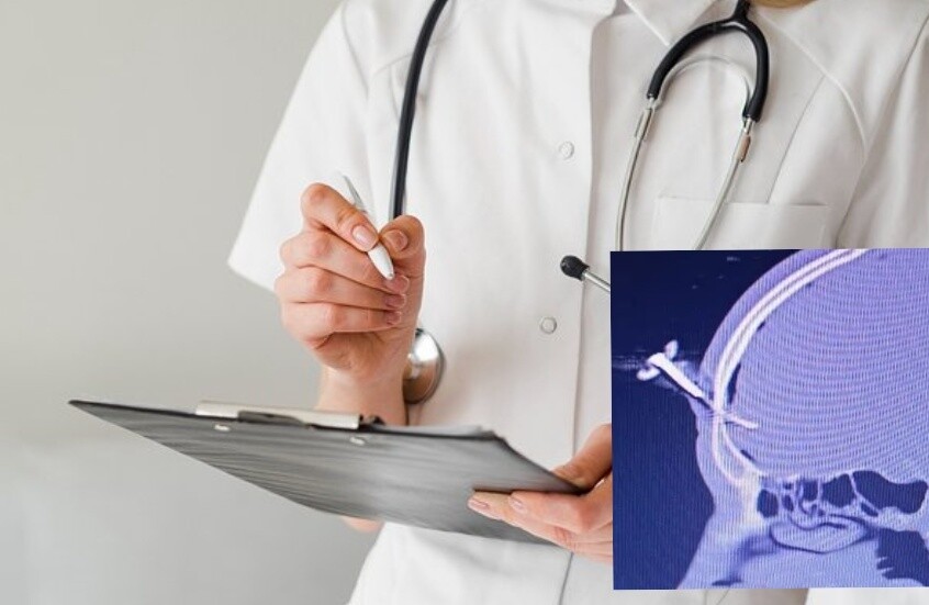 مفتاح سيارة يستقر في جبينه.. لاعب سابق يتعرض لإصابة غريبة