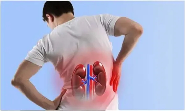 المرض الصامت.. لماذا لا يدرك الناس فشل الكلى مبكرًا؟