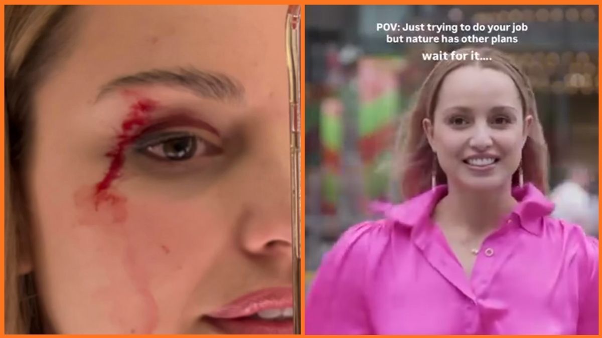 طائر يصطدم بوجه مراسلة نيوزيلاندية على المباشر ويصيبها بجروح (فيديو)