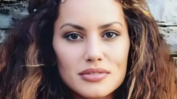 فنانة تركية توثق تعرضها للضرب من زوجها .. وتنشر الصور