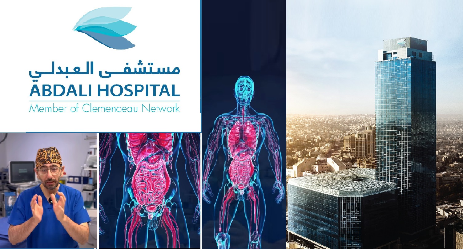 مستشفى العبدلي .. ماذا يقول الدكتور يمان التل.. حول أمراض البروستات