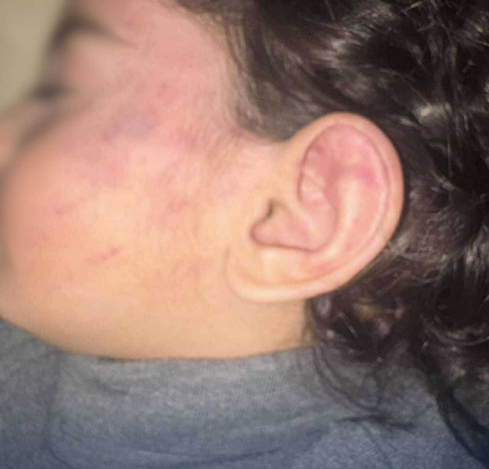 تعرض طفل للتعذيب على يد مالكة حضانة غير مرخصة.. صور