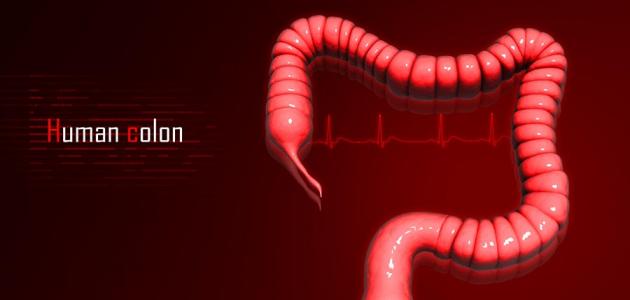 أعراض سرطان القولون: علامات يجب الانتباه لها