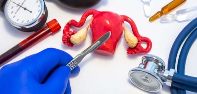 ما هي الآثار المترتبة على استئصال الرحم؟