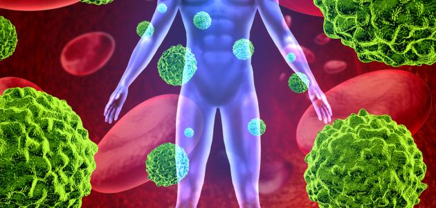 فقر الدم الخبيث: الأسباب والأعراض والعلاج