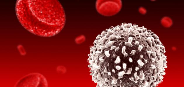 أسباب تجرثم الدم وأعراضه وعوامل خطر الإصابة