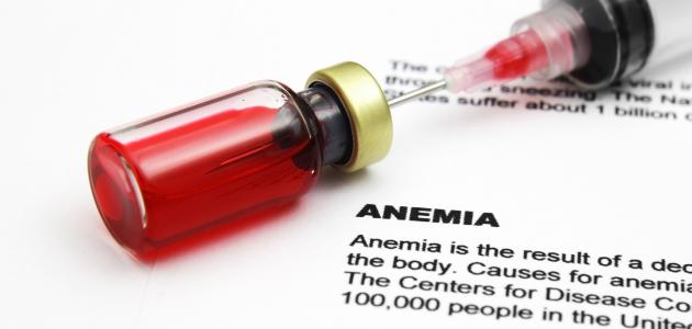 فقر الدم: تعريفه وأعراضه وأسبابه