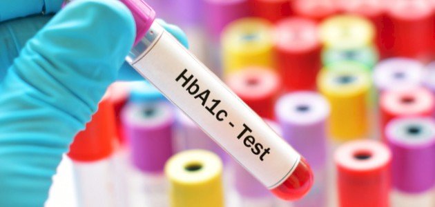 كيفية إجراء تحليل السكر التراكمي بفاعلية