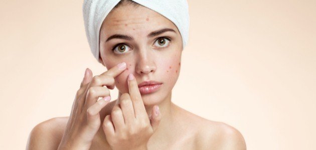 ماسكات طبيعية فعالة لعلاج حب الشباب
