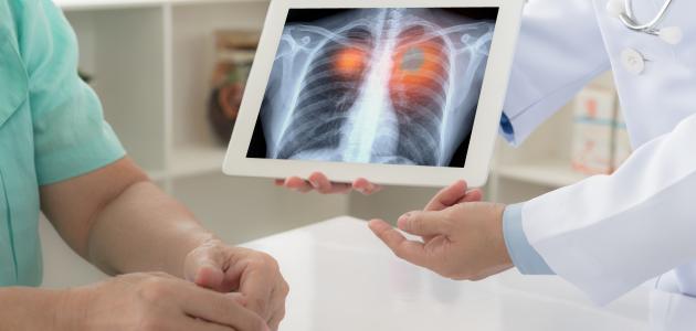 تشخيص مرض الربو: خطوات وإجراءات دقيقة