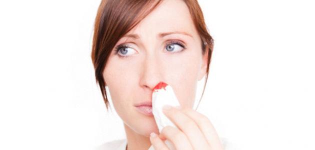 رعاف الأنف عند الحامل: الأسباب والأعراض والعلاج